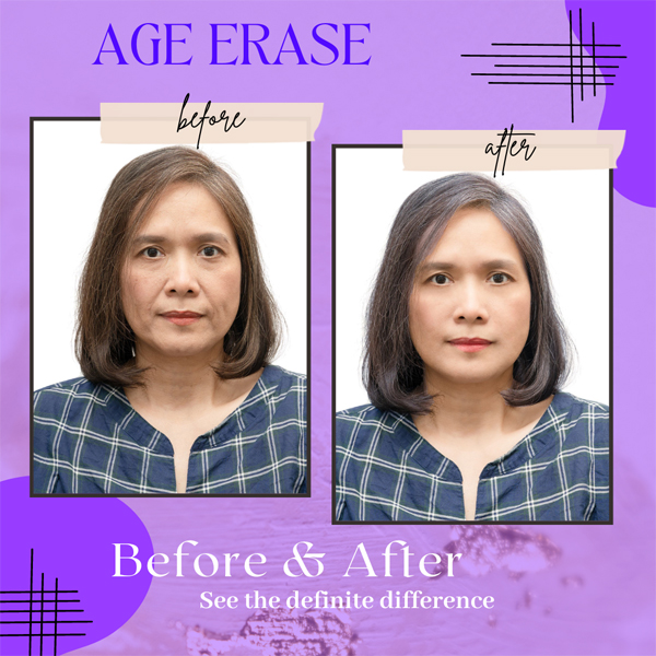 age-erase1
